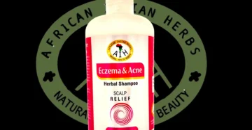 Eczema & Acne Herbal Shampoo(Scalp Relief)